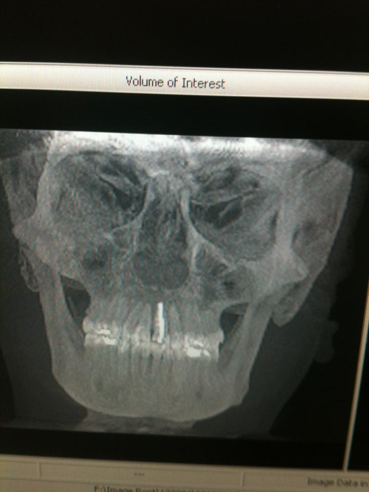 image_1363203273235854